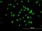 Autoantigen NOR-90 antibody, H00007343-M03, Novus Biologicals, Immunofluorescence image 