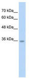 Alpha Tubulin Acetyltransferase 1 antibody, TA329479, Origene, Western Blot image 