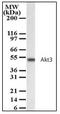 RAC-gamma serine/threonine-protein kinase antibody, AP23601PU-N, Origene, Western Blot image 