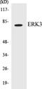 Mitogen-Activated Protein Kinase 6 antibody, EKC1200, Boster Biological Technology, Western Blot image 