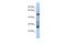 Testis Expressed 47 antibody, A18366, Boster Biological Technology, Western Blot image 