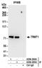 N(2),N(2)-dimethylguanosine tRNA methyltransferase antibody, A304-205A, Bethyl Labs, Immunoprecipitation image 