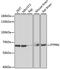 Protein Tyrosine Phosphatase Receptor Type N antibody, 22-191, ProSci, Western Blot image 