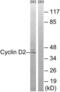 Cyclin D2 antibody, LS-C118355, Lifespan Biosciences, Western Blot image 