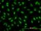 YY1 Transcription Factor antibody, H00007528-M04, Novus Biologicals, Immunocytochemistry image 