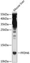 Prefoldin Subunit 6 antibody, 13-735, ProSci, Western Blot image 