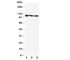 ATPase Sarcoplasmic/Endoplasmic Reticulum Ca2+ Transporting 1 antibody, R30809, NSJ Bioreagents, Western Blot image 