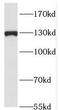 RAB3 GTPase Activating Protein Catalytic Subunit 1 antibody, FNab07030, FineTest, Western Blot image 