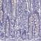 Myosin regulatory light chain 2, skeletal muscle isoform antibody, HPA055059, Atlas Antibodies, Immunohistochemistry paraffin image 