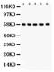 ArfGAP With FG Repeats 1 antibody, RP1071, Boster Biological Technology, Western Blot image 