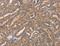 Cell Division Cycle Associated 4 antibody, MBS2521368, MyBioSource, Immunohistochemistry paraffin image 