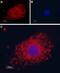Polycystin 2, Transient Receptor Potential Cation Channel antibody, PA5-77328, Invitrogen Antibodies, Immunocytochemistry image 