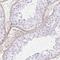 PDZD2 antibody, HPA064387, Atlas Antibodies, Immunohistochemistry frozen image 