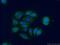Dehydrogenase/Reductase 9 antibody, 14560-1-AP, Proteintech Group, Immunofluorescence image 