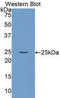 Laminin subunit alpha-4 antibody, LS-C295079, Lifespan Biosciences, Western Blot image 