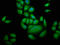 Gem Nuclear Organelle Associated Protein 4 antibody, LS-C672211, Lifespan Biosciences, Immunofluorescence image 