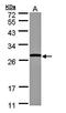 Glutathione S-Transferase Theta 1 antibody, orb73659, Biorbyt, Western Blot image 