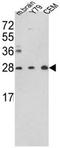 Triosephosphate Isomerase 1 antibody, AP17804PU-N, Origene, Western Blot image 