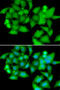 Ubiquitin Associated And SH3 Domain Containing B antibody, 22-735, ProSci, Immunofluorescence image 