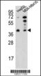Poly(ADP-Ribose) Polymerase Family Member 16 antibody, 62-236, ProSci, Western Blot image 