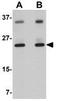 Thioesterase Superfamily Member 4 antibody, GTX31383, GeneTex, Western Blot image 