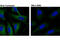 EMAP Like 4 antibody, 12156S, Cell Signaling Technology, Immunocytochemistry image 