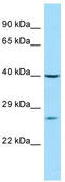 Phosphatidylserine Decarboxylase antibody, TA338091, Origene, Western Blot image 