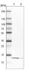 YbeY Metalloendoribonuclease antibody, NBP1-89876, Novus Biologicals, Western Blot image 