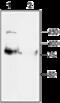 Potassium Voltage-Gated Channel Subfamily Q Member 1 antibody, GTX54839, GeneTex, Western Blot image 