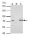 Protein Arginine Methyltransferase 5 antibody, GTX116004, GeneTex, Immunoprecipitation image 