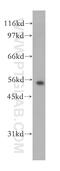 Potassium Voltage-Gated Channel Subfamily J Member 16 antibody, 12696-1-AP, Proteintech Group, Western Blot image 