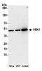 Serine/threonine-protein kinase 51PK antibody, A305-269A, Bethyl Labs, Western Blot image 