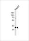 Proteasome Activator Subunit 2 antibody, LS-C162249, Lifespan Biosciences, Western Blot image 
