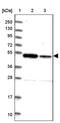 Zinc Finger Protein 662 antibody, PA5-58662, Invitrogen Antibodies, Western Blot image 