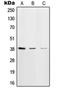 DNA Polymerase Beta antibody, orb214414, Biorbyt, Western Blot image 