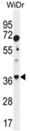 Zebrin II antibody, AP50143PU-N, Origene, Western Blot image 