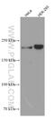 Centrosomal Protein 170B antibody, 66749-1-Ig, Proteintech Group, Western Blot image 