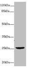 Neuronal Growth Regulator 1 antibody, CSB-PA015692LA01HU, Cusabio, Western Blot image 