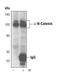 Catenin alpha-2 antibody, MA5-14963, Invitrogen Antibodies, Immunoprecipitation image 