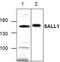 Spalt Like Transcription Factor 1 antibody, TA318882, Origene, Western Blot image 