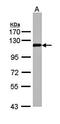 Zinc fingers and homeoboxes protein 2 antibody, orb69806, Biorbyt, Western Blot image 