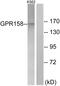 G Protein-Coupled Receptor 158 antibody, PA5-39624, Invitrogen Antibodies, Western Blot image 