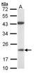 Dual Specificity Phosphatase 3 antibody, LS-C186048, Lifespan Biosciences, Western Blot image 