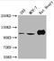 Actinin Alpha 2 antibody, CSB-PA001242LA01HU, Cusabio, Western Blot image 