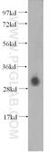 Deoxyribonuclease 1 Like 3 antibody, 11330-1-AP, Proteintech Group, Western Blot image 