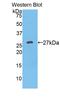 Kallikrein Related Peptidase 3 antibody, LS-C294982, Lifespan Biosciences, Western Blot image 