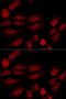 p53BP1 antibody, orb178635, Biorbyt, Immunocytochemistry image 