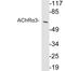 Neuronal acetylcholine receptor subunit alpha-3 antibody, LS-C199757, Lifespan Biosciences, Western Blot image 