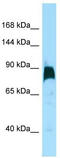 Kinesin-like protein KIF7 antibody, TA343184, Origene, Western Blot image 