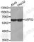 Ubiquitin Specific Peptidase 22 antibody, A2303, ABclonal Technology, Western Blot image 